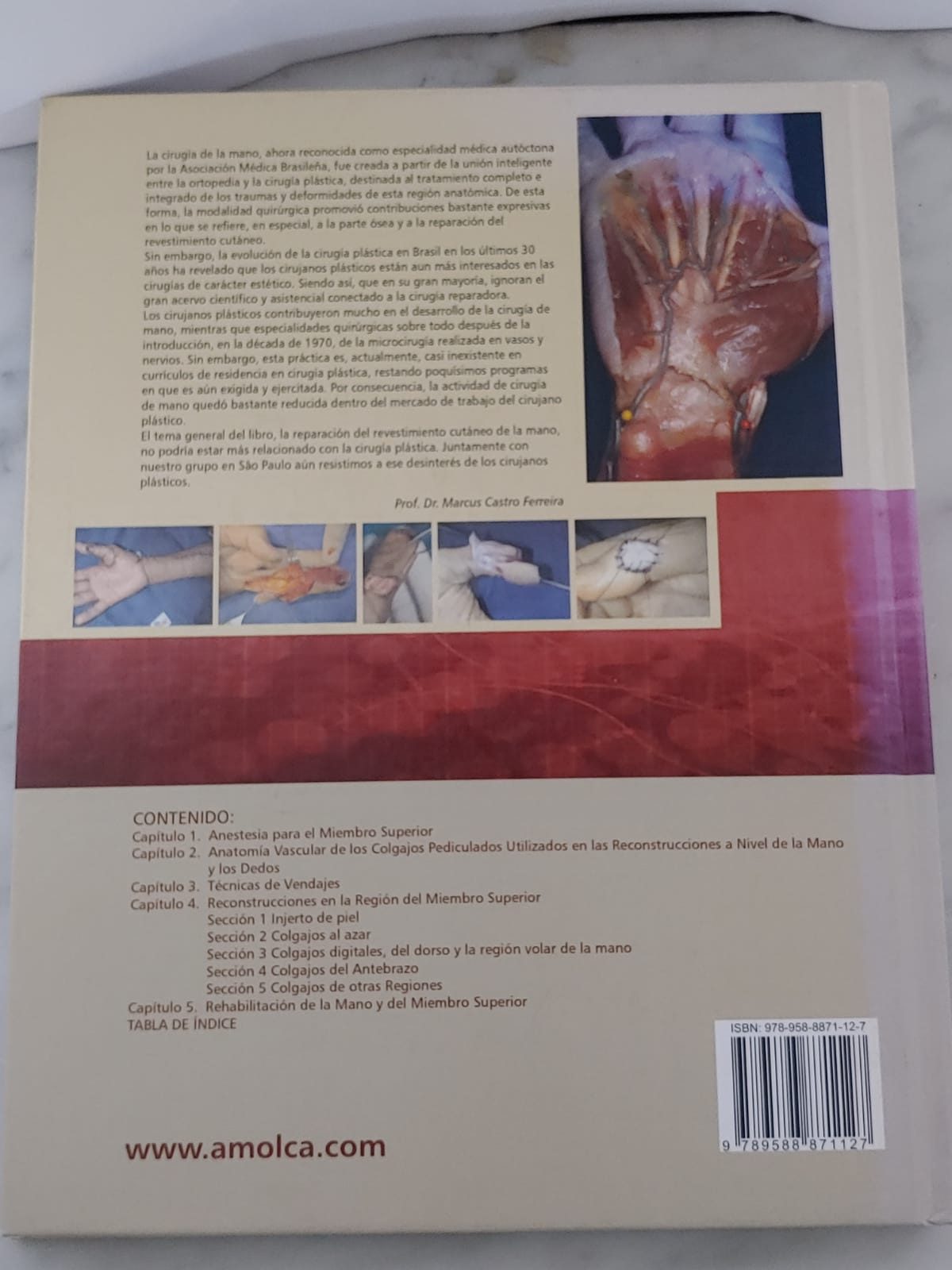 "COBERTURA CUTÁNEA DE MANOS Y DEDOS" de Dr. Pedro Bijos y el Dr. João Recalde Rocha. Primera Edición. - Imagen 5