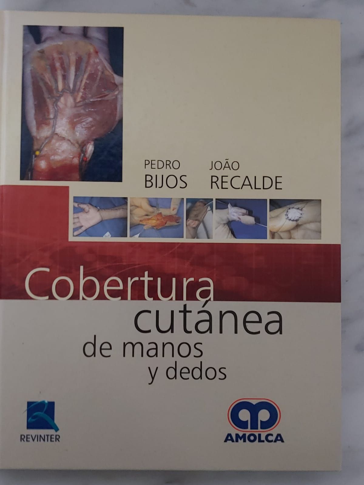 "COBERTURA CUTÁNEA DE MANOS Y DEDOS" de Dr. Pedro Bijos y el Dr. João Recalde Rocha. Primera Edición.
